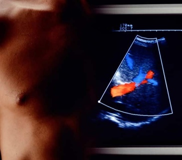 Ecografo di ultima generazione per l’ecocardiografia 3D