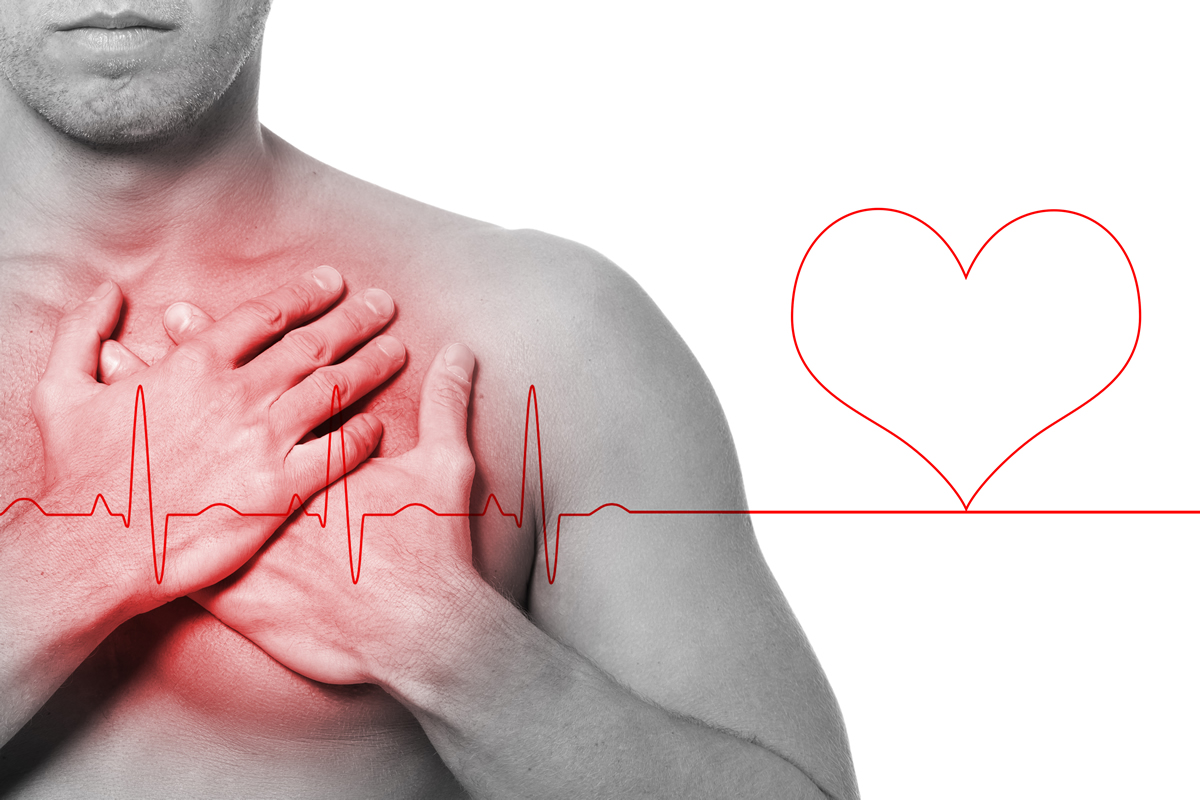 Le malattie cardiovascolari sono la prima causa di morte nel mondo occidentale